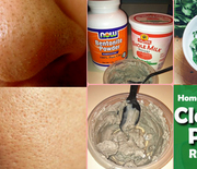 Thumb_remedies-for-clogged-pores