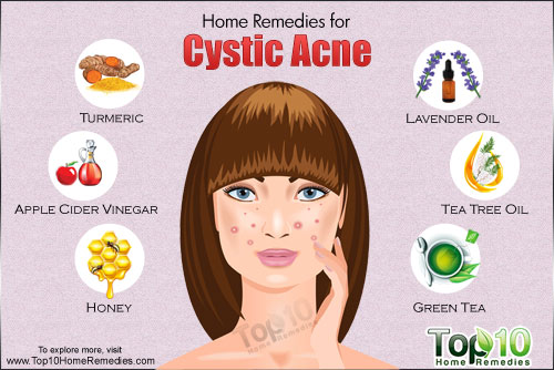 Cystic-acne-500