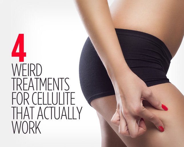 Wh-4-weird-treatments-cellulite_0