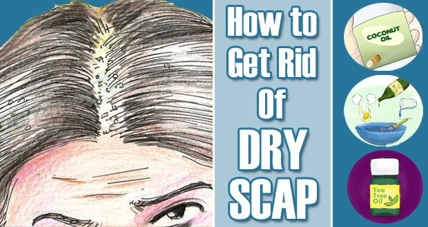 Get-rid-of-dry-scalp