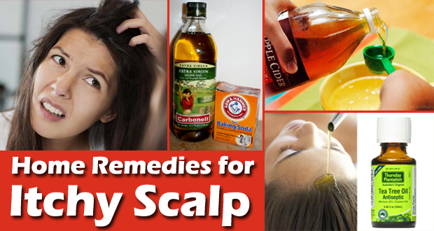 Remedies-for-itchy-scalp