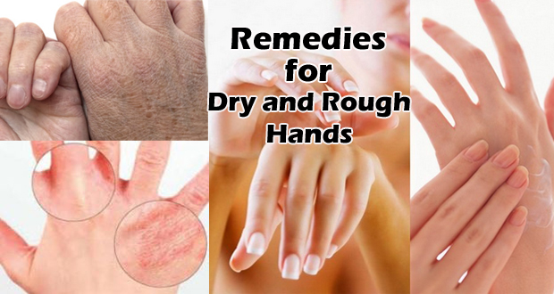 Dry-and-rough-hands