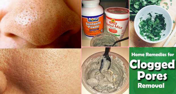 Remedies-for-clogged-pores