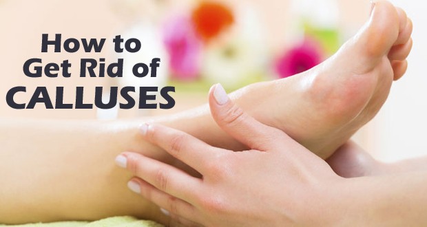 How-to-get-rid-of-calluses-620x330