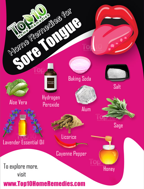 Home-remedies-for-sore-tongue