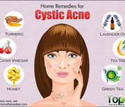 Thumb_cystic-acne-500