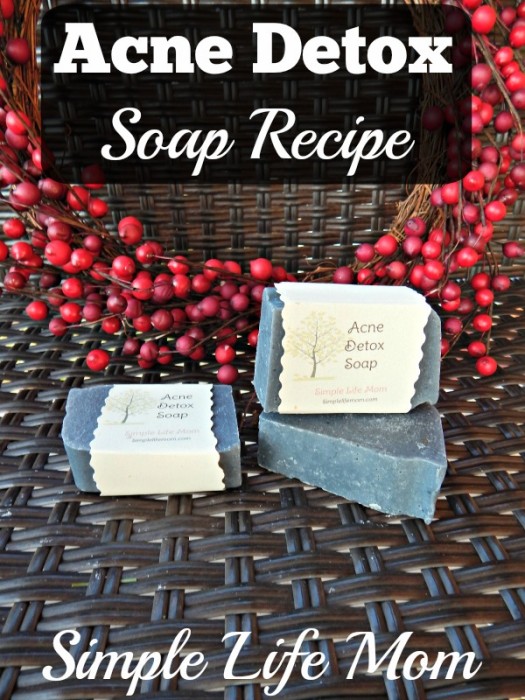 Acne-detox-soap-recipe-525x700