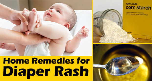 Home-remedies-for-diaper-rash