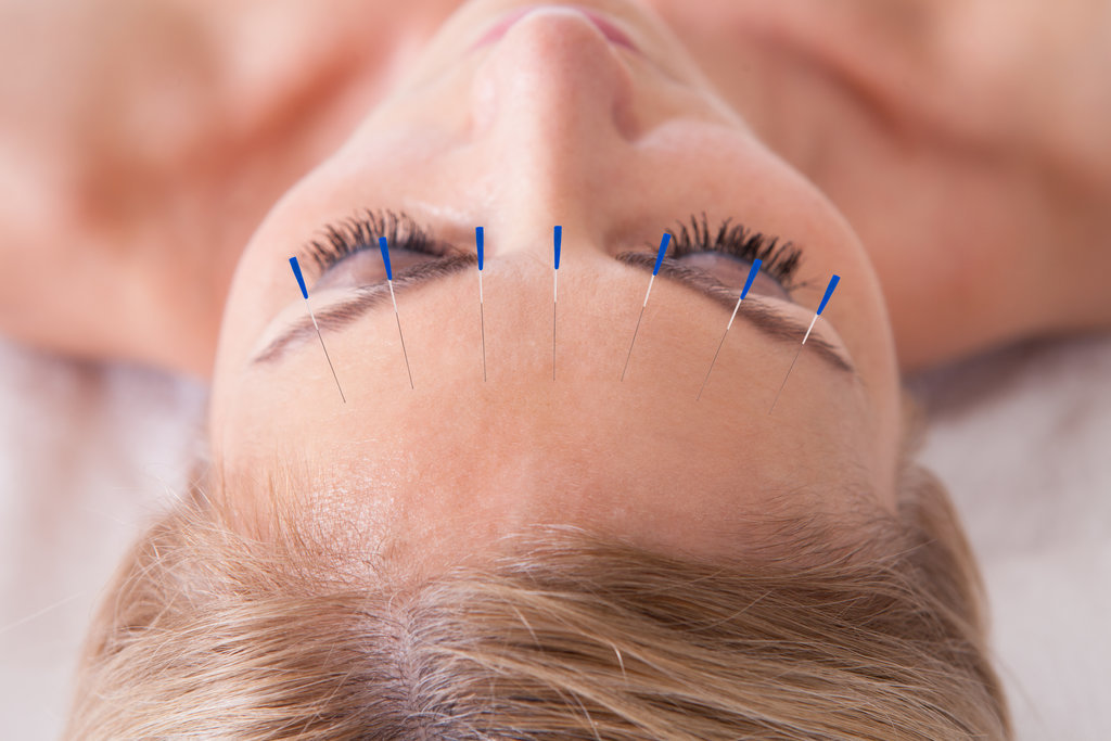 Skin-care-benefits-acupuncture