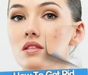 Thumb_get-rid-of-pimples-overnight-naturally-and-fast